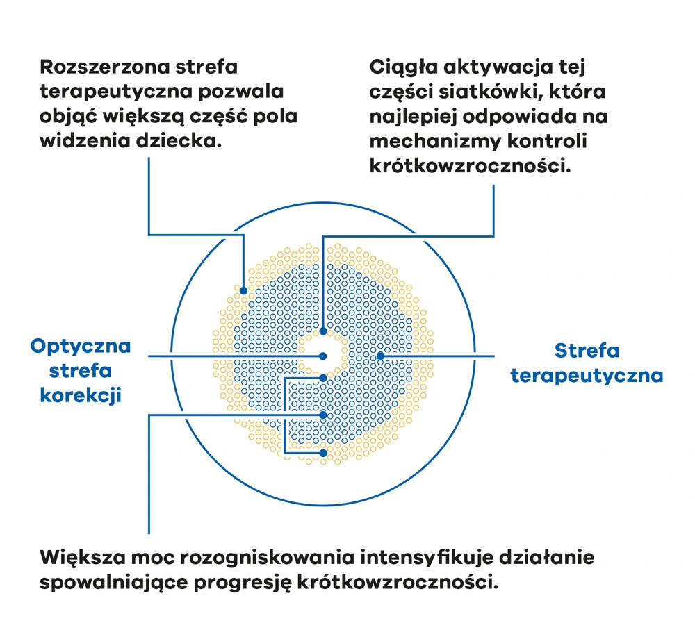 Schemat budowy soczewki MiYOSMART iQ D.I.M.S. TED: optyczna strefa korekcji i rozszerzona strefa terapeutyczna